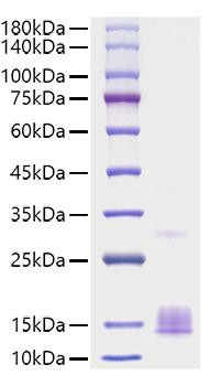 Recombinant Mouse CCL2/MCP-1 Protein (RPCB1140)