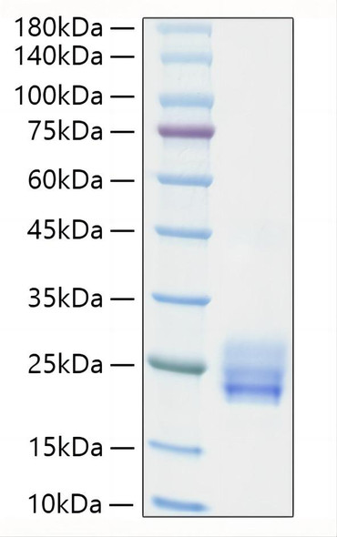 Recombinant Human IL-25/IL-17E Protein (RPCB1142)