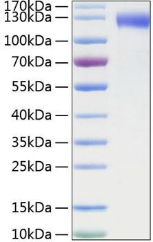 Recombinant Mouse E-selectin/SELE/CD62E Protein (RPCB1150)