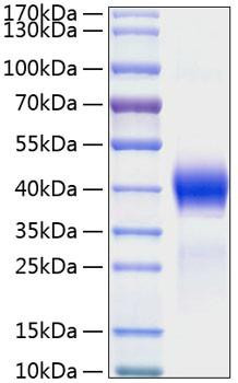 Recombinant Mouse Dkk-1 Protein (RPCB1154)