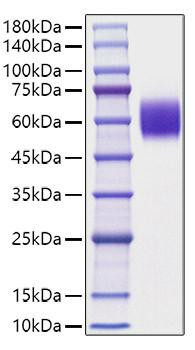 Recombinant Mouse Apolipoprotein H/ApoH Protein (RPCB1156)