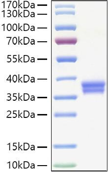 Recombinant Human VSIG3/IgSF11 Protein (RPCB1164)