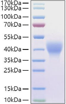 Recombinant Mouse Leukemia inhibitory factor/LIF Protein (RPCB1165)