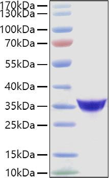 Recombinant Human Adiponectin/Acrp30/ADIPOQ Protein (RPCB1183)