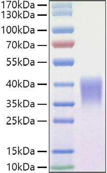Recombinant Mouse Ephrin-B2/EFNB2 Protein (RPCB1184)
