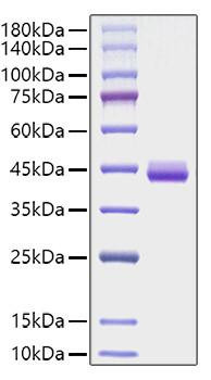 Recombinant Human CCL11/Eotaxin Protein (RPCB1197)