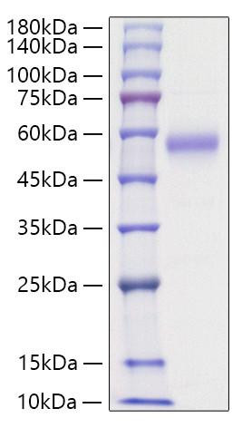 Recombinant Human IL-5RA/CD125 Protein (RPCB1201)