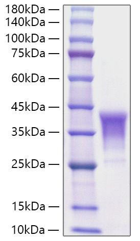 Recombinant Human TNFSF8/CD30 Ligand/CD153 Protein (RPCB1207)