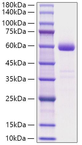 Recombinant Human NBL1 Protein (RPCB1212)