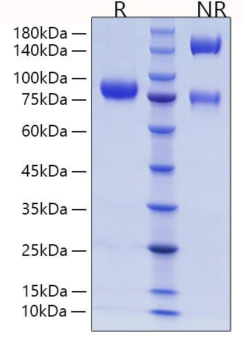 Recombinant Human Endoglin/ENG/CD105 Protein (RPCB1246)