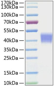 Recombinant Mouse IL-21R/CD360 Protein (RPCB1255)