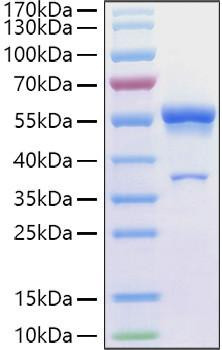 Recombinant Human Ephrin-A1/EFNA1 Protein (RPCB1258)