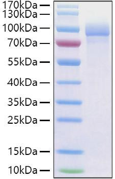 Recombinant Human Fibronectin/CIG/FN1 Protein (RPCB1259)