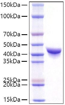 Recombinant Mouse YKL-40/CHI3L1 Protein (RPCB1262)