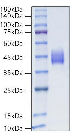 Recombinant Human TEM8/ANTXR1 Protein (RPCB1267)