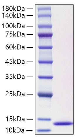 Recombinant Human CCL3L1 Protein (RPCB1275)