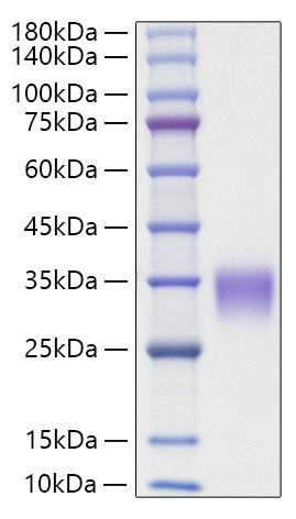 Recombinant Rat Oncostatin-M/OSM Protein (RPCB1280)