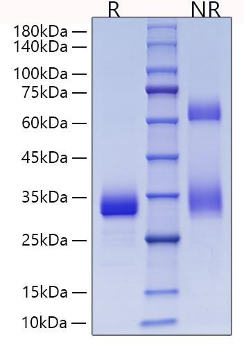 Recombinant Mouse Adiponectin/Acrp30/ADIPOQ Protein (RPCB1294)