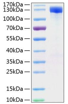 Recombinant Mouse ErbB-2/HER2/CD340 Protein (RPCB1295)