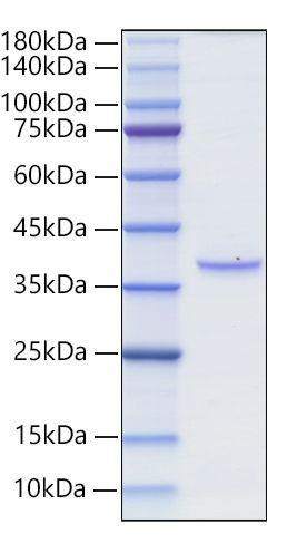 Recombinant Rat TNFRSF17/BCMA/CD269 Protein (RPCB1300)