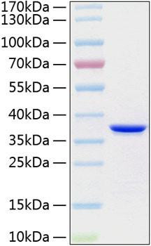 Recombinant Human Annexin A5/ANXA5 Protein (RPCB1301)