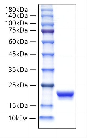 Recombinant Human IFN-alpha G/IFNA5 Protein (RPCB1330)
