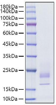 Recombinant Rat IFN-gamma Protein (RPCB1342)