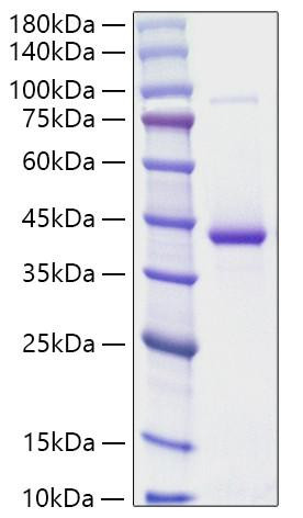 Recombinant Human RETN Protein (RPCB1370)