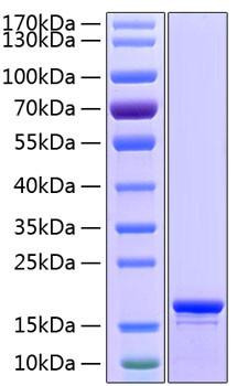 Recombinant Human Stathmin/STMN1 Protein (RPCB1389)