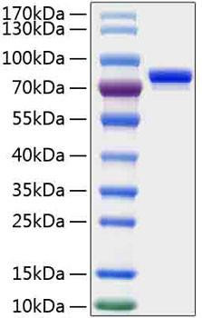 Recombinant Human SLAMF3/LY9/CD229 Protein (RPCB1397)