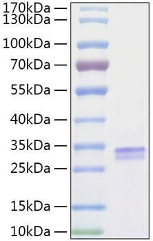 Recombinant Human VSIG2 Protein (RPCB1398)