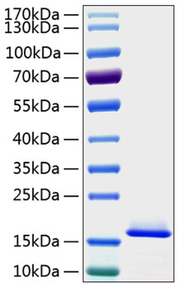 Recombinant Human SUMO-1 Protein (RPCB1400)