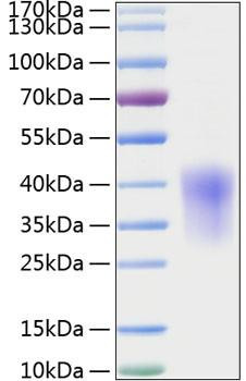 Recombinant Rat CCL2/MCP-1 Protein (RPCB1407)