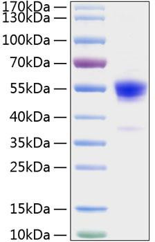 Recombinant Rat IFN-gamma Protein (RPCB1408)