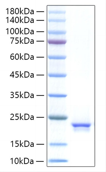 Recombinant Human IFN-alpha 21 Protein (RPCB1412)