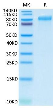 Recombinant Human Integrin beta-6/ITGB6 Protein (RPCB1419)