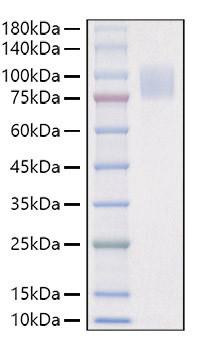 Recombinant Mouse IL-17RA/CD217 Protein (RPCB1467)