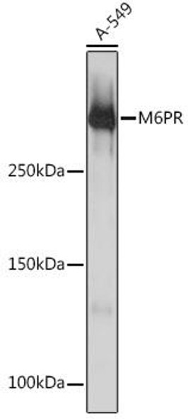 Anti-M6PR Antibody (CAB3762)