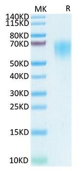 Recombinant SARS-COV-2 Spike S1 NTD Protein (RPCB1478)