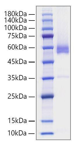 Recombinant Human TNFSF7/CD27 Ligand/CD70 Protein (RPCB1497)