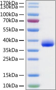 Recombinant SARS-CoV-2 Spike RBD  Protein (RPCB1515)
