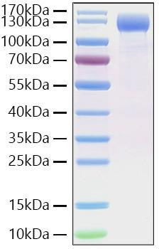 Recombinant SARS-CoV-2 Spike S1(D614G) Protein (RPCB1516)