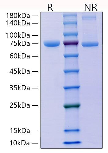 Recombinant Mouse E-Cadherin/CDH1/CD324 Protein (RPCB1523)