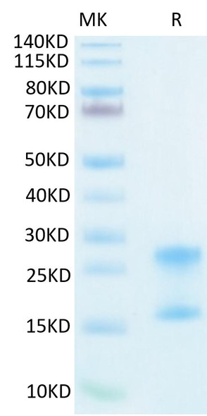 Recombinant Human IL-17A&IL-17F Protein (RPCB1549)