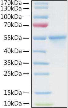 Recombinant Human Carbonic anhydrase 9 Protein (RPCB1550)