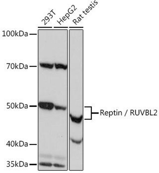 Anti-Reptin / RUVBL2 Antibody (CAB4227)
