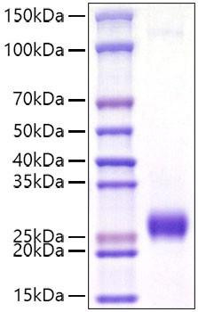 Recombinant Mouse Ephrin-A2/EFNA2 Protein (RPCB1556)