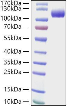 Recombinant Human CDCP1/gp140/CD318 Protein (RPCB1563)