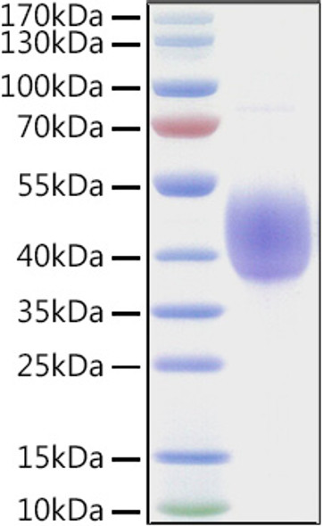 Recombinant Human NKAT-6/KIR2DL2/CD158b1 Protein (RPCB1564)
