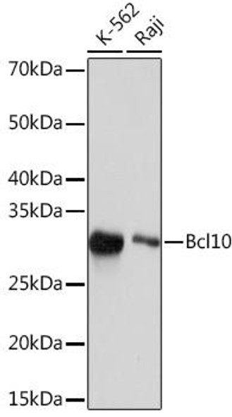 Anti-Bcl10 Antibody (CAB4520)